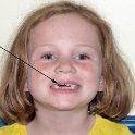 New Lost Tooth